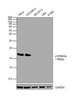 p16INK4a Antibody in Western Blot (WB)