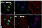 WT1 Antibody