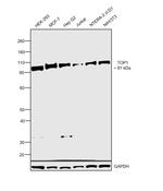 TOP1 Antibody in Western Blot (WB)