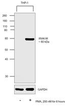 IRAK-M Antibody in Western Blot (WB)