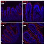 ACE2 Antibody in Immunocytochemistry (ICC/IF)