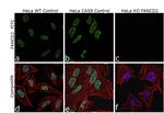 FANCD2 Antibody in Immunocytochemistry (ICC/IF)