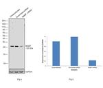 MGMT Antibody in Western Blot (WB)