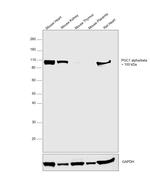 PGC1 alpha/beta Antibody in Western Blot (WB)