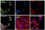 VAMP2 Antibody in Immunocytochemistry (ICC/IF)