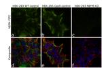 NEFM Antibody in Immunocytochemistry (ICC/IF)