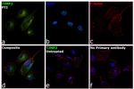 TIMP2 Antibody in Immunocytochemistry (ICC/IF)