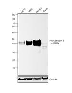 Cathepsin B Antibody in Western Blot (WB)