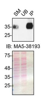 SFRP1 Antibody in Immunoprecipitation (IP)