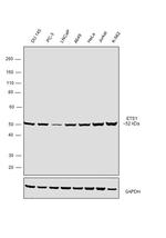 ETS1 Antibody in Western Blot (WB)