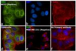 TFF1 Antibody in Immunocytochemistry (ICC/IF)