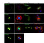 KIF11 Antibody in Immunocytochemistry (ICC/IF)