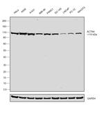 alpha Actinin 4 Antibody