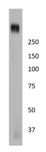 PIEZO1 Antibody in Western Blot (WB)