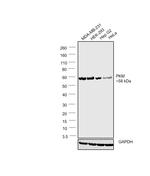 PKM2 Antibody in Western Blot (WB)