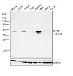 TdT Antibody in Western Blot (WB)