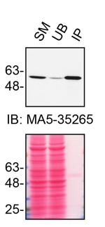 RXRA Antibody in Immunoprecipitation (IP)