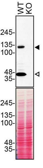 beta Dystroglycan Antibody