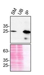 CHMP2B Antibody in Immunoprecipitation (IP)