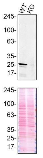 CHMP2B Antibody in Western Blot (WB)