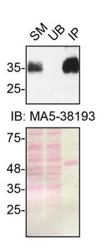 SFRP1 Antibody in Immunoprecipitation (IP)