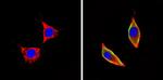 ICAM-1 Antibody in Immunocytochemistry (ICC/IF)