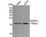 CENPA Antibody in Western Blot (WB)