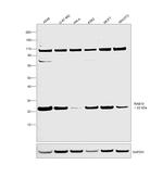 RAB10 Antibody in Western Blot (WB)