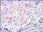 MEK7 Antibody in Immunohistochemistry (Paraffin) (IHC (P))