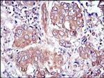 ERK1 Antibody in Immunohistochemistry (Paraffin) (IHC (P))