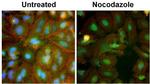 MDM2 Antibody in Immunocytochemistry (ICC/IF)