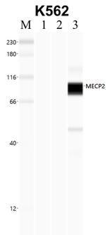 MECP2 Antibody in Immunoprecipitation (IP)