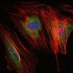 MMP9 Antibody in Immunocytochemistry (ICC/IF)