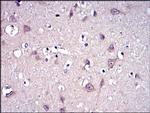 MMP9 Antibody in Immunohistochemistry (Paraffin) (IHC (P))