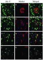 Phospho-Tau (Ser202, Thr205) Antibody in Immunohistochemistry (IHC)