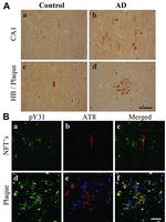 Phospho-Tau (Ser202, Thr205) Antibody in Immunohistochemistry (IHC)