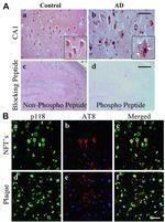 Phospho-Tau (Ser202, Thr205) Antibody in Immunohistochemistry (IHC)