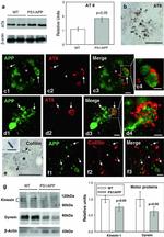 beta Amyloid (1-42) Antibody in Immunohistochemistry (IHC)