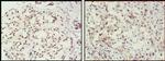 MSH2 Antibody in Immunohistochemistry (Paraffin) (IHC (P))