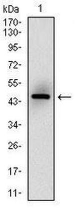 MSH6 Antibody in Western Blot (WB)