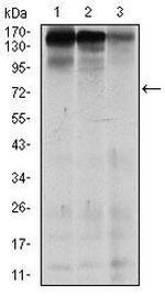 MSH6 Antibody in Western Blot (WB)