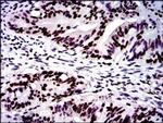 MSH6 Antibody in Immunohistochemistry (Paraffin) (IHC (P))