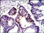 MSH6 Antibody in Immunohistochemistry (Paraffin) (IHC (P))