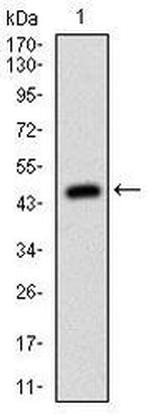 MSH6 Antibody in Western Blot (WB)