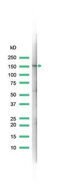 MSH6 Antibody in Western Blot (WB)