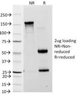 Lewis A (Blood Group Antigen) Antibody in SDS-PAGE (SDS-PAGE)