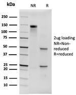 Hexa-histidine (Epitope Tag) Antibody in SDS-PAGE (SDS-PAGE)