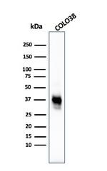 Melanoma Marker (MART-1 + Tyrosinase + gp100) Antibody in Western Blot (WB)