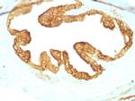 Cytokeratin, pan Antibody in Immunohistochemistry (Paraffin) (IHC (P))