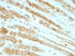 Cytokeratin, pan Antibody in Immunohistochemistry (Paraffin) (IHC (P))